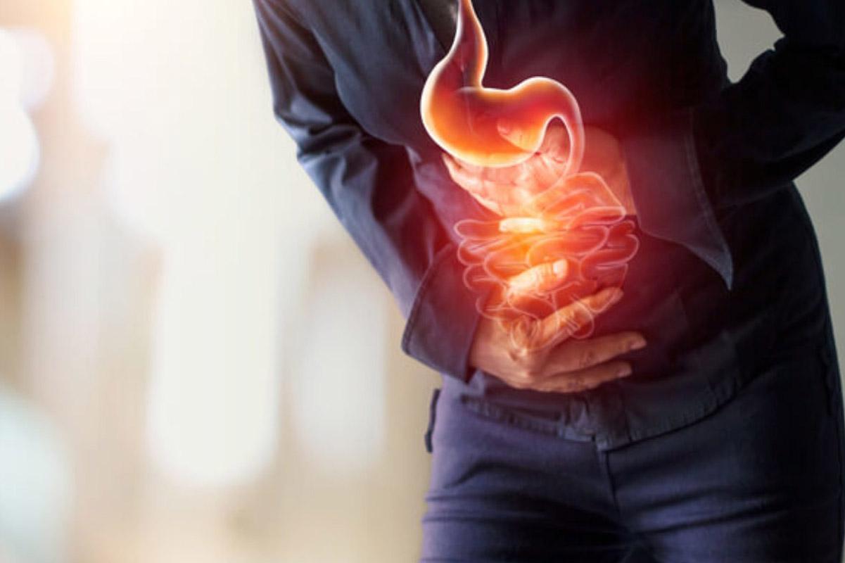 What-is-Acid-reflux-and-GERD